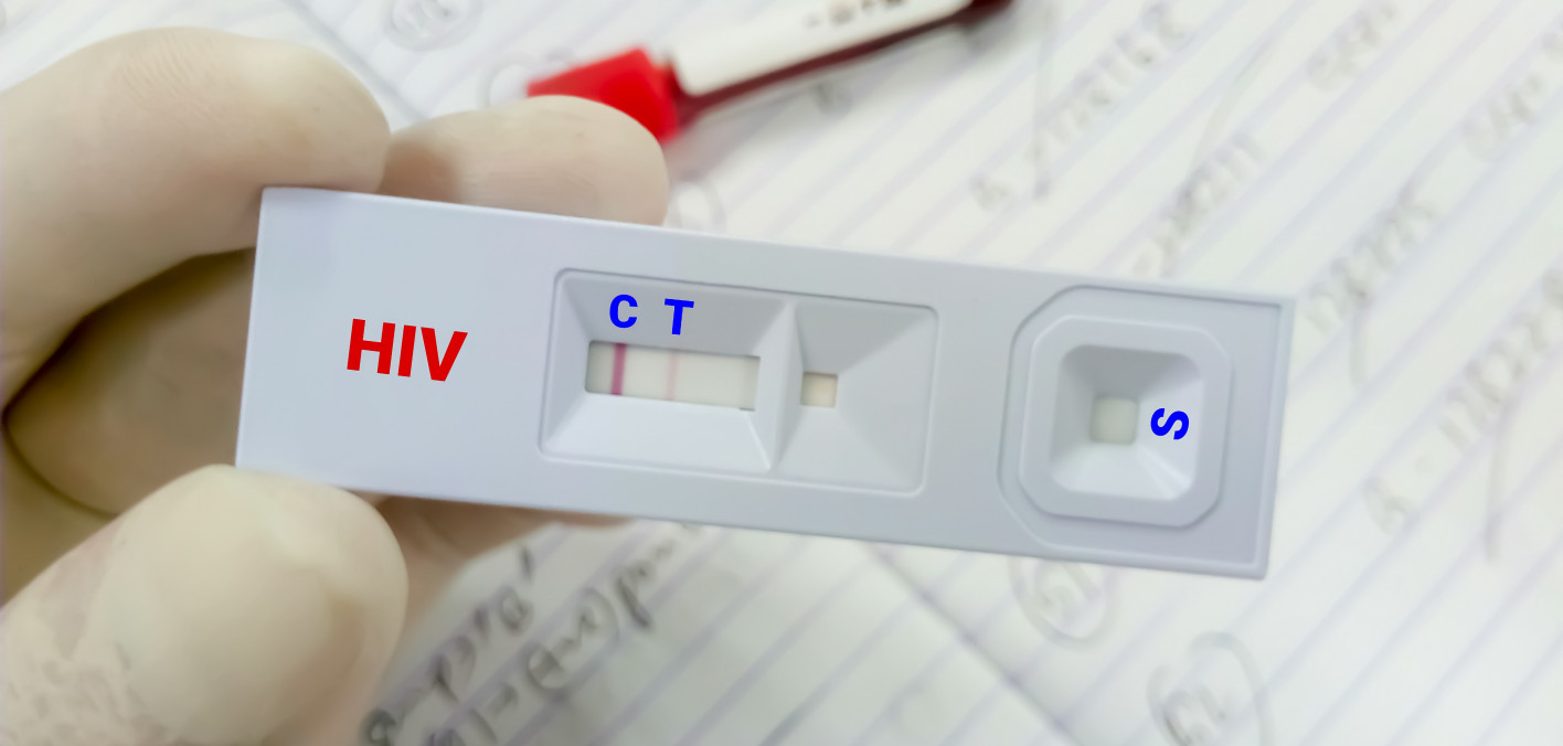 Willingness to use HIV pre-exposure prophylaxis among gay men, other men  who have sex with men and transgender women in Myanmar - AIS Learning  Platform